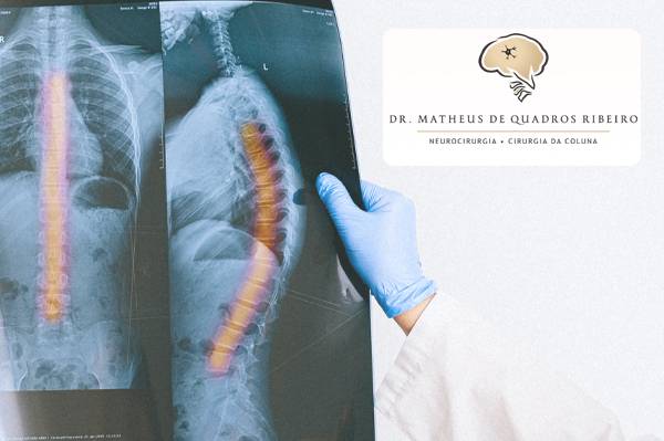 Fraturas tóraco-lombares